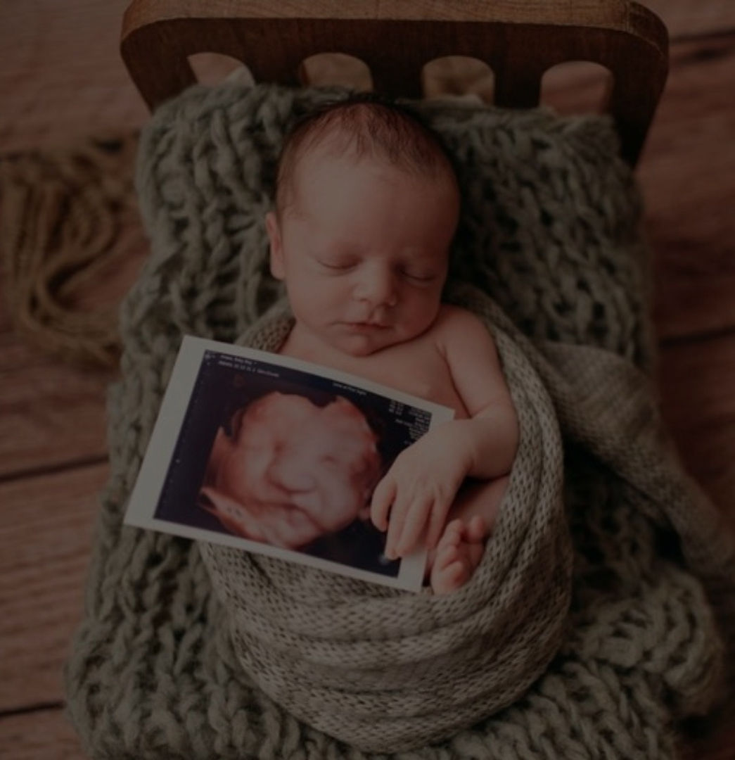 3d 4d 5d 6d Ultrasound Studio First Sight Frederick Frederick 3d 4d 5d 6d Ultrasound Studio First Sight Frederick Frederick