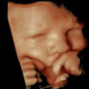 Bebé niño Topiah_19.JPG