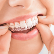 Coloque Invisalign em Nova Friburgo com a Dra. Liz Moraes