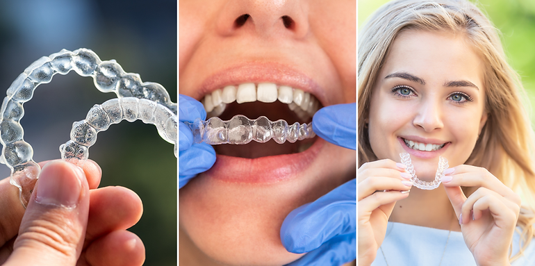 Invisalign aparelho invisível Nova Friburgo.png