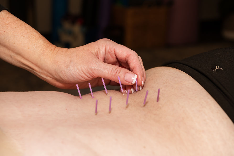 TP dry needling 