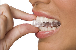 aligner_1.jpg