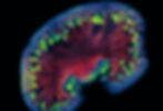 Daniyal Jafree's winning entry to the Royal Society of Medicine Imaging in Nephrology Award 2019