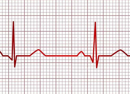 EKG.jpeg
