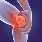 OSTEOARTHRITIS