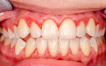 www.strobeldentistry.com.png