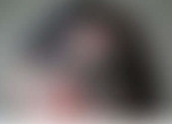 抜け毛