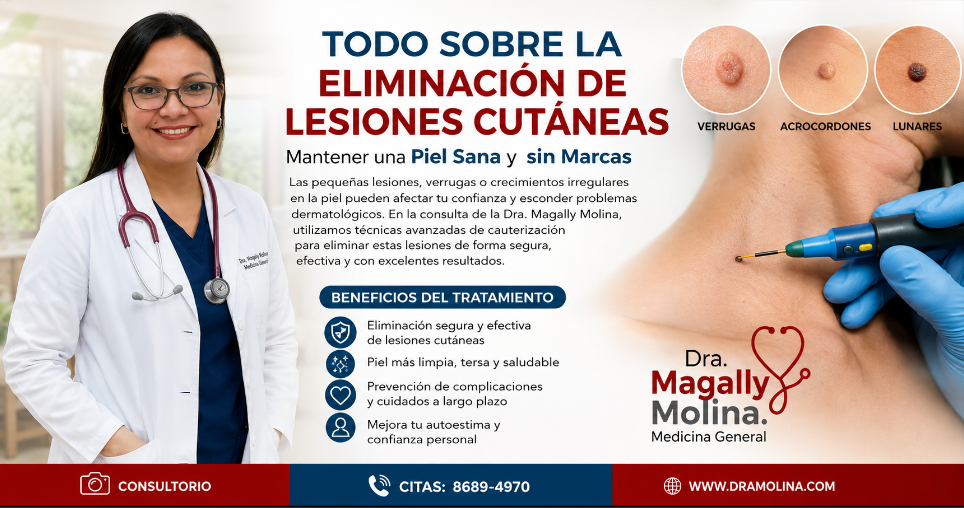 Todo sobre la Eliminación de Lesiones Cutáneas