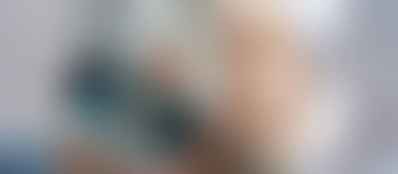 Prise d'empreintes avec scanner 3D