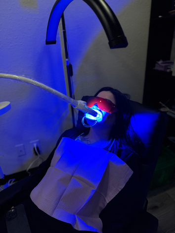 Under UV light l teeth whitening treatment