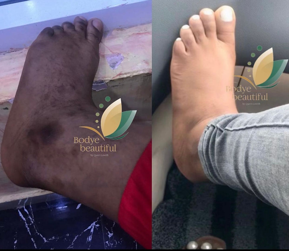 Feet Skin Repair