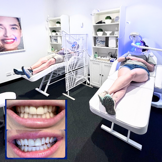 Teeth whitening 