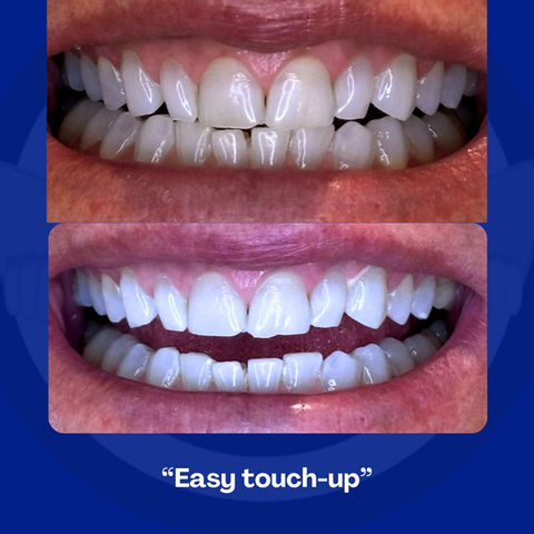easy touch up