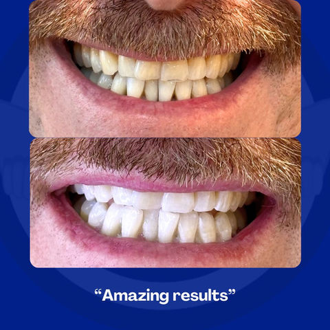 amazing result