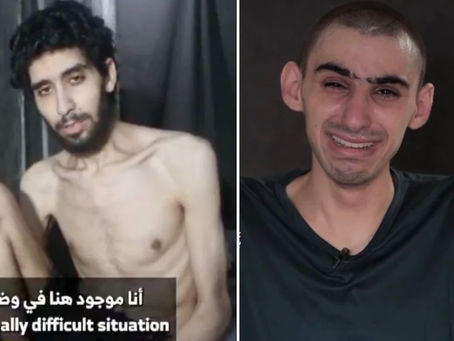 Hypocrisy exposed – International outlets largely ignore emaciated Israeli hostages after featuring false starving Gaza children pictures