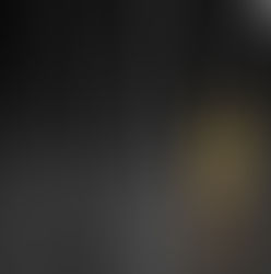 About My Aches: Runner's Knee