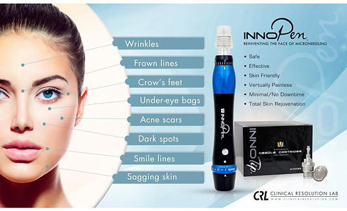microneedling-langley-bc.jpeg