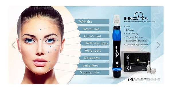 InnoPen Microneedling System