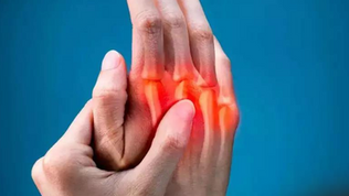 Rheumatoid Arthritis Awareness Day 2024: Exploring the Background, Importance, and Indicators of this Chronic Condition