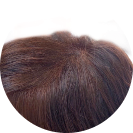 アフター自然なヘアピース、つむじ部分画像