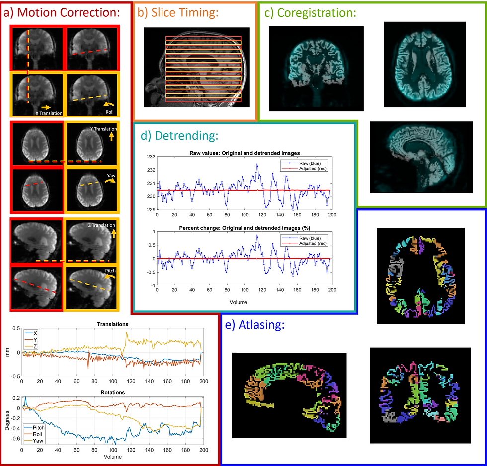 A very dense diagram with images for preprocessing steps Motion Correction, Slice Timing, Coregistration, Detrending, and Atlasing. Some of the graphs are brain images and others are line graphs of various points. This image appears in my thesis where a more thorough caption is included.