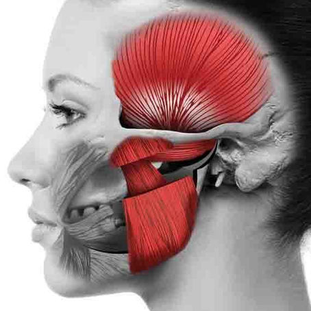 Masseter kasının yüzeysel ve derin liflerini gösteren, çene ve elmacık kemiğiyle ilişkisini anlatan anatomik yüz illüstrasyonu