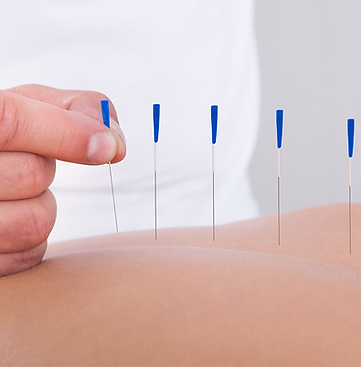Melbourne Acupuncture Chinese Medicine 墨尔本 中医 针灸
