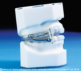 osa dental.jpg