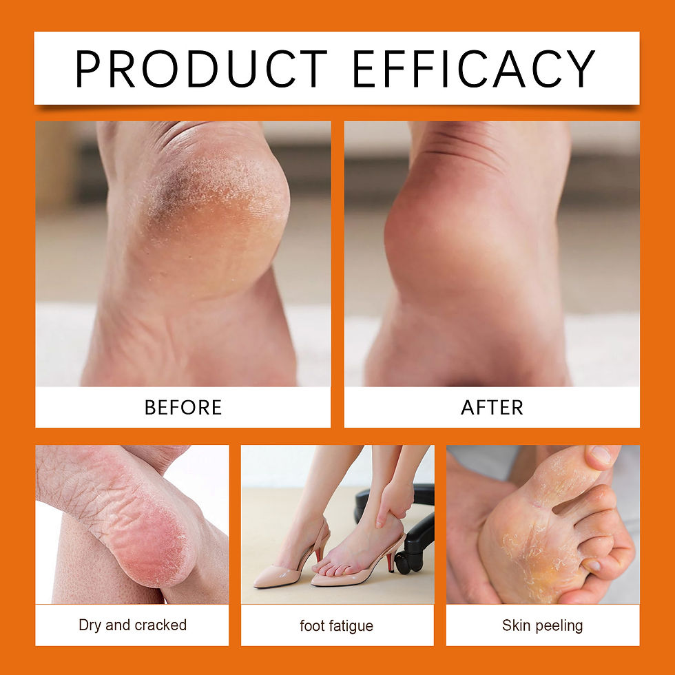 Thumbnail: Honey Foot Care Cream Stick Nourishing Balm for Dry Cracked Feet Heel Exfoliatio