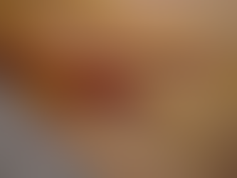 Training and Recovery After an Inguinal Hernia Operation (mesh)