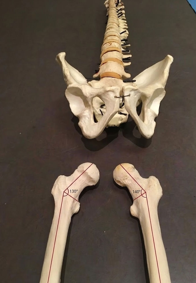 Comparaison de deux fémurs humains issus de la collection privée de Dominique Martin, montrant une variabilité de l'angle cervico-diaphysaire entre un col de fémur à 130 degrés et un autre plus ouvert à 140 degrés.
