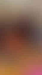 Analyse du pied de Julien par Dominique Martin Ostéopathe