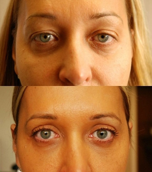 Guylaines-eyes-485x548.jpg