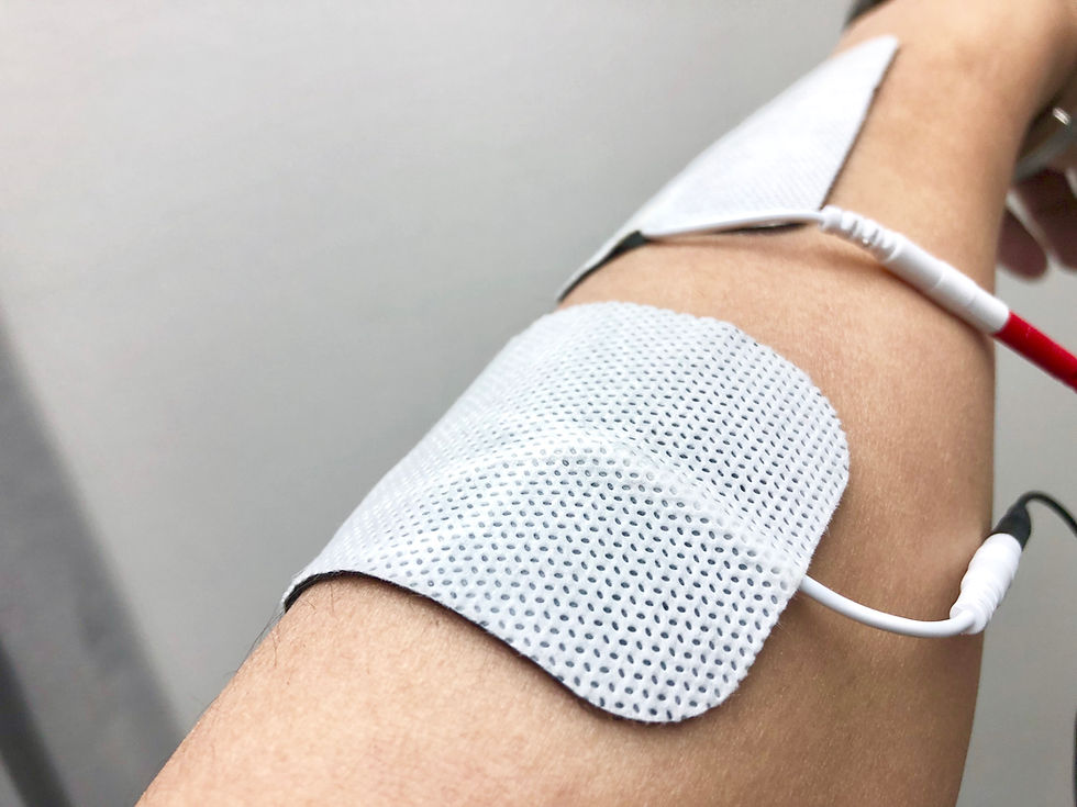 縮圖：Plexus Electrical Stimulation
