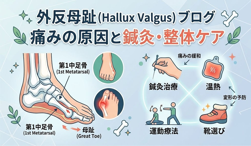 【靴のせいだけじゃない?】外反母趾の本当の原因と、鍼灸・姿勢から整える最新アプローチ