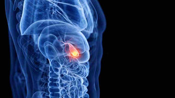 Is durvalumab a breakthrough treatment for gallbladder cancer?