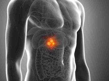 Will circulating tumor DNA help in the detection of gallbladder cancer??
