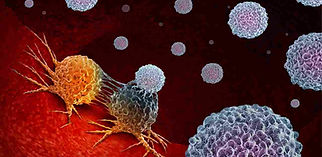 Brainsteam glioma
