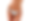 BODY CONTOURING