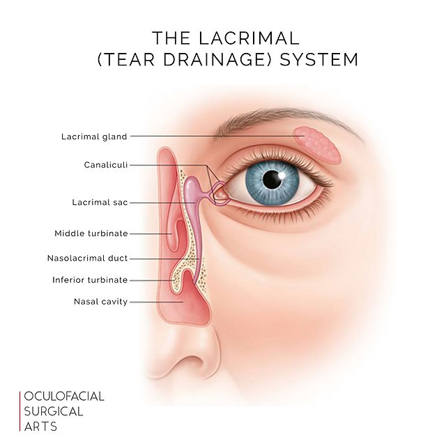 Ephiphora: What Causes Teary Eyes?