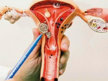 女性如何被免做傷害卵巢的事情