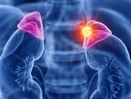 腎上腺壓力-從健康到失衡-探索不同階段的影響