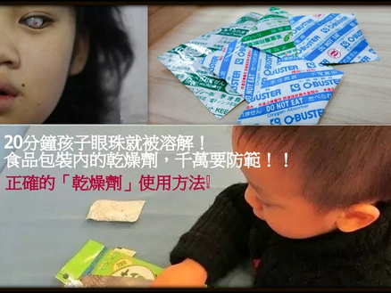 食品包裝內的乾燥劑20分鐘把孩子眼珠溶解