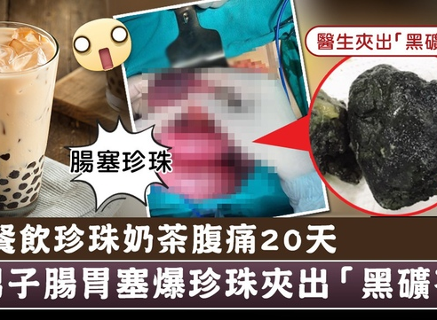 餐餐飲珍珠奶茶被夾出「黑礦石」塞爆腸胃