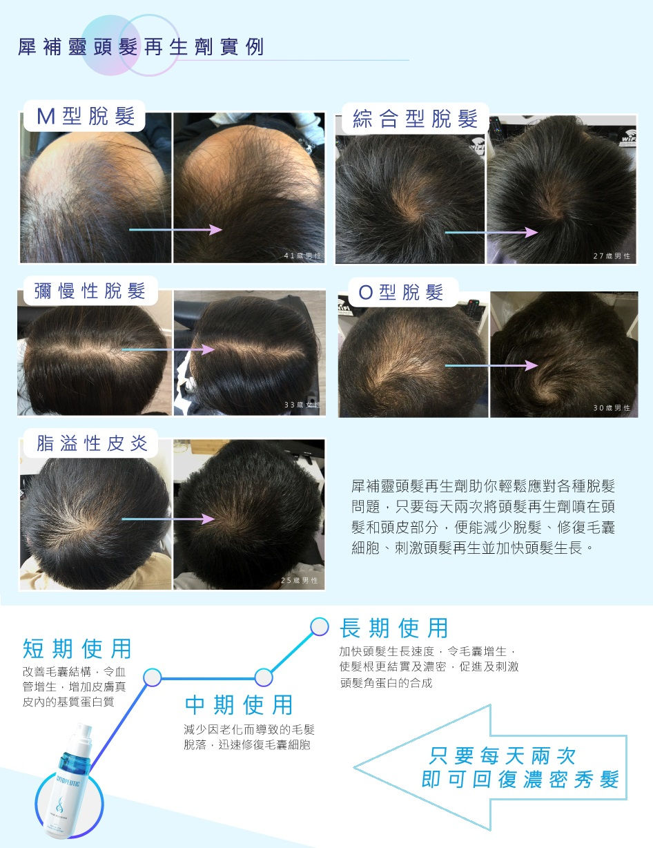 縮圖：犀補靈頭髮再生劑 Cytopeutic Hair Booster
