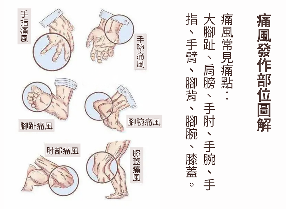 痛風專用複合配方 五種天然草本協同利尿及消炎效果,維持尿酸平衡,預防尿酸過度積聚。
抗發炎、抗菌、清熱解毒、行血、利濕、消腫、散熱止癢、清涼利尿。