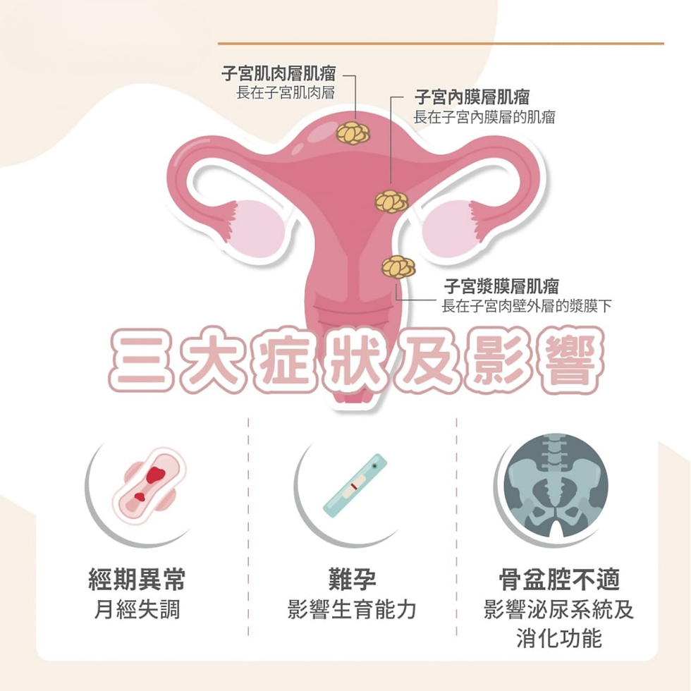 【子宮肌瘤】前兆-成因-症狀-治療-子宮瘤食物禁忌一覽