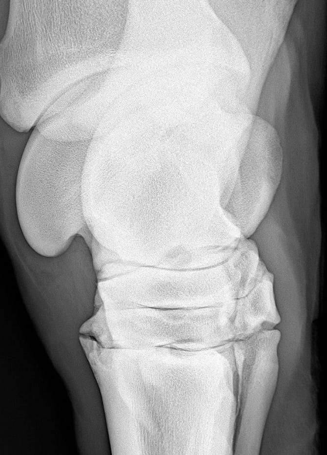 Radiografia che evidenzia segni di artrosi articolare