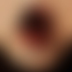 ANOVA SKYWAY PREMIERE “DIET OF WORMS” VIDEO VIA BRAVEWORDS