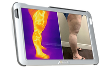 thermpix.png